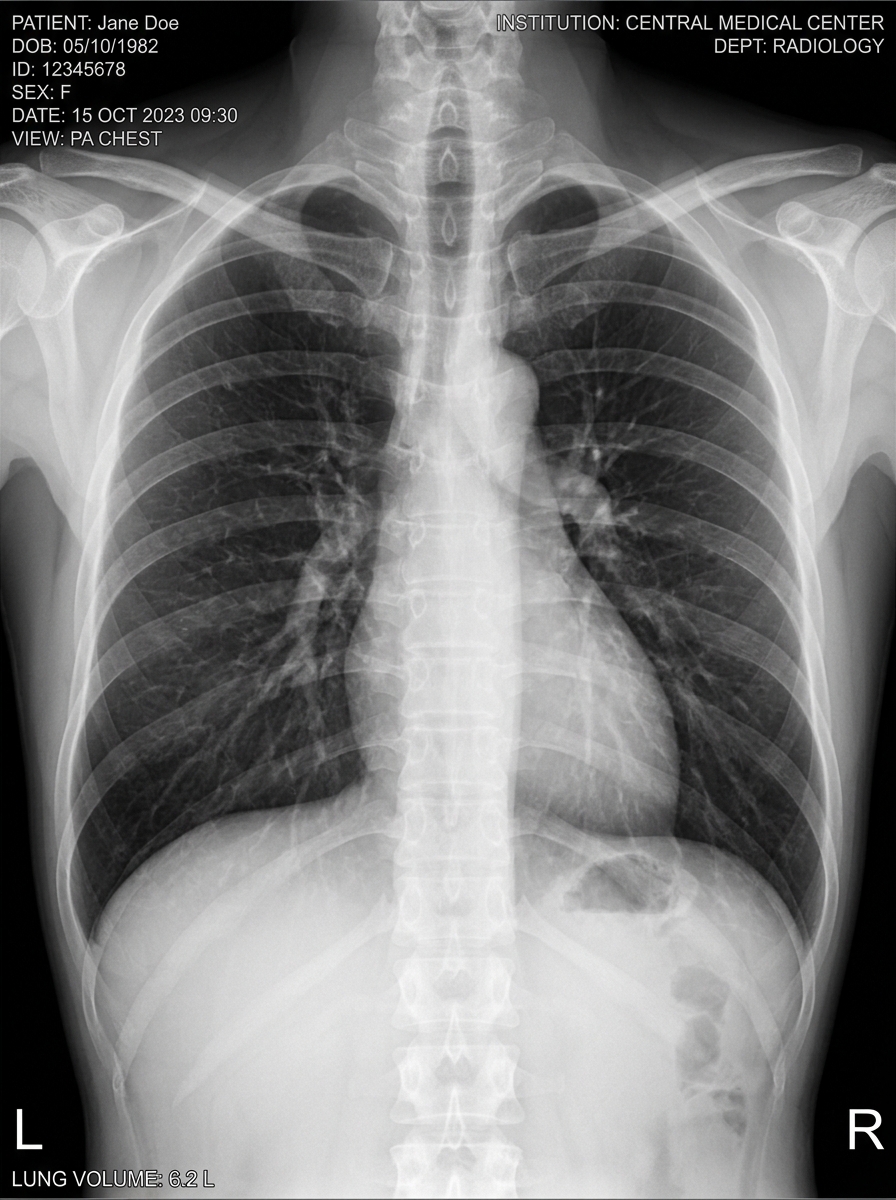 Thorax Scan